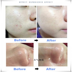 Ipartner Hydrogen oxygen lille boble hydrofacial 6 i 1 multifunktionshudrenser