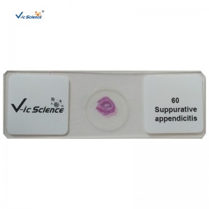 100stk menneskelige patologiske dias mikroskopiske forberedte lysbilleder