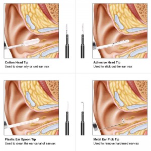 Wifi Otoscope 3 in 1 Ear Wax Remover Tool 720P vandtæt kamera med 6 justerbar LED kompatibel med Android og iOS