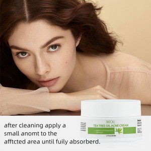 Tetræ olie acne creme