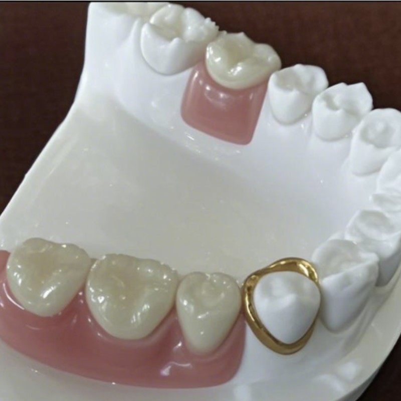 Præcision tilknytning