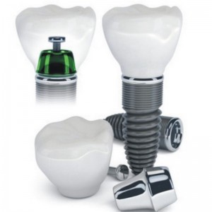 Dentalimplantat